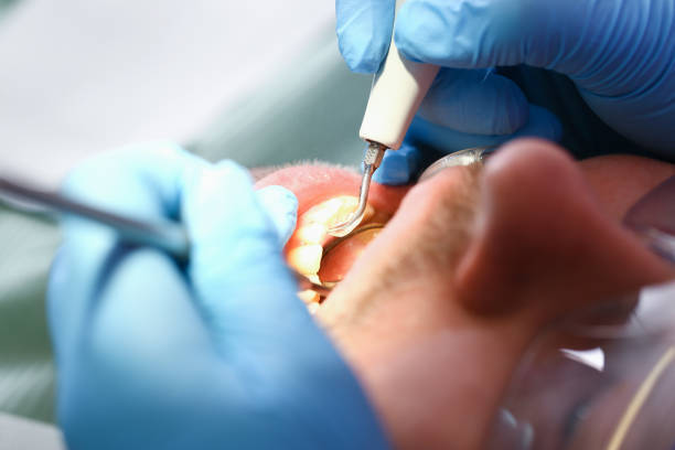 Best Emergency Dental Services for Seniors in Dutch Island, GA
